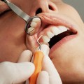 Can dentist clean teeth instead of hygienist?